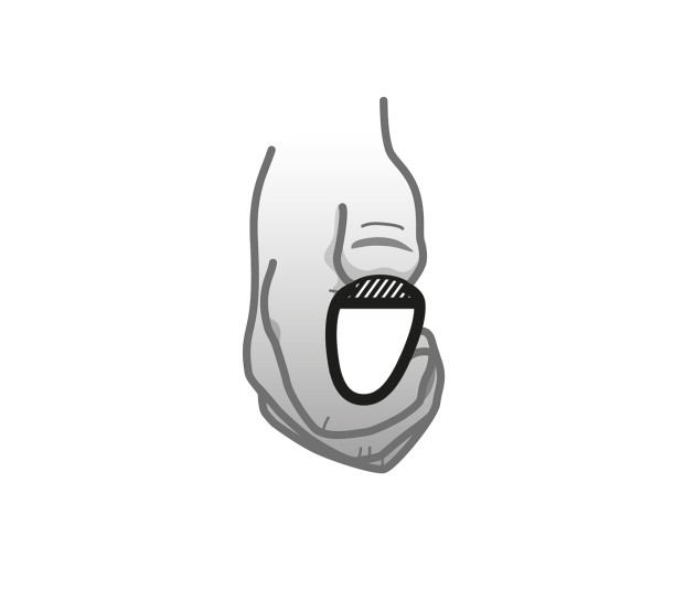 Carbo Life Handrim GEKKO S